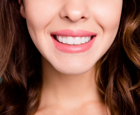 Capturededental bonding resinntal bonding resin