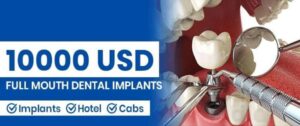 Dental Implants In India (1)