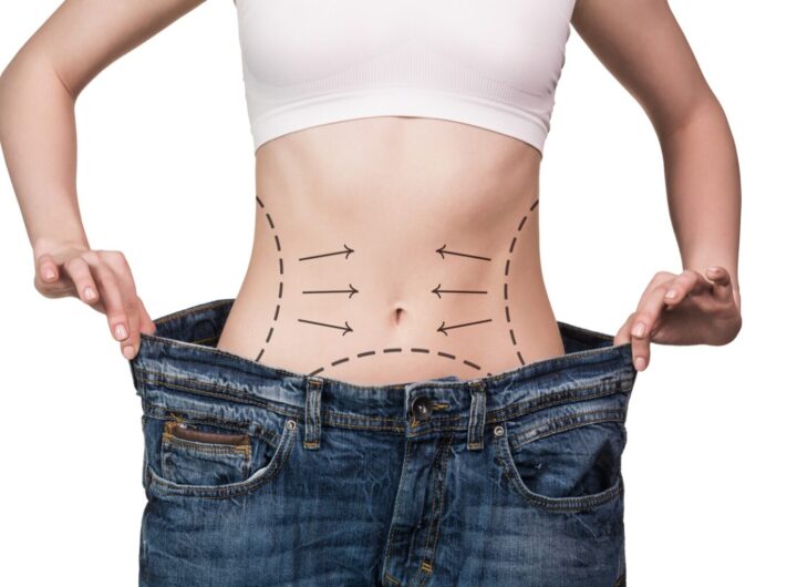 weight loss surgery Melbourne